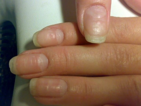 О чем говорят наши ногти?