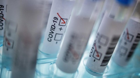 В России нашли новый способ лечения коронавируса