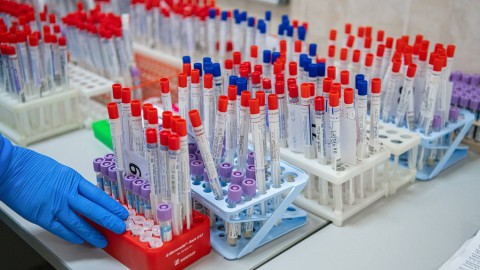 В Екатеринбурге начнут бесплатно тестировать на антитела к коронавирусу