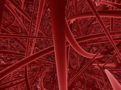 Кому срочно надо провериться на наличие атеросклероза